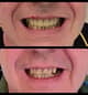 Slider image (10) Dr. Aleksandar Kovacevic - Dental Clinic in Croatia